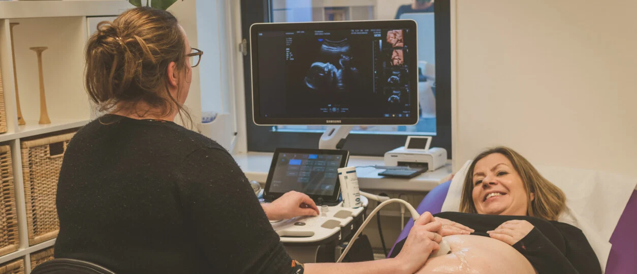 Wanneer is een 4D echo het mooist?